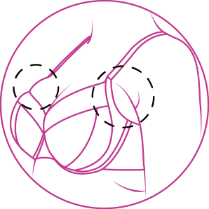 Illustration of a bra with a gap